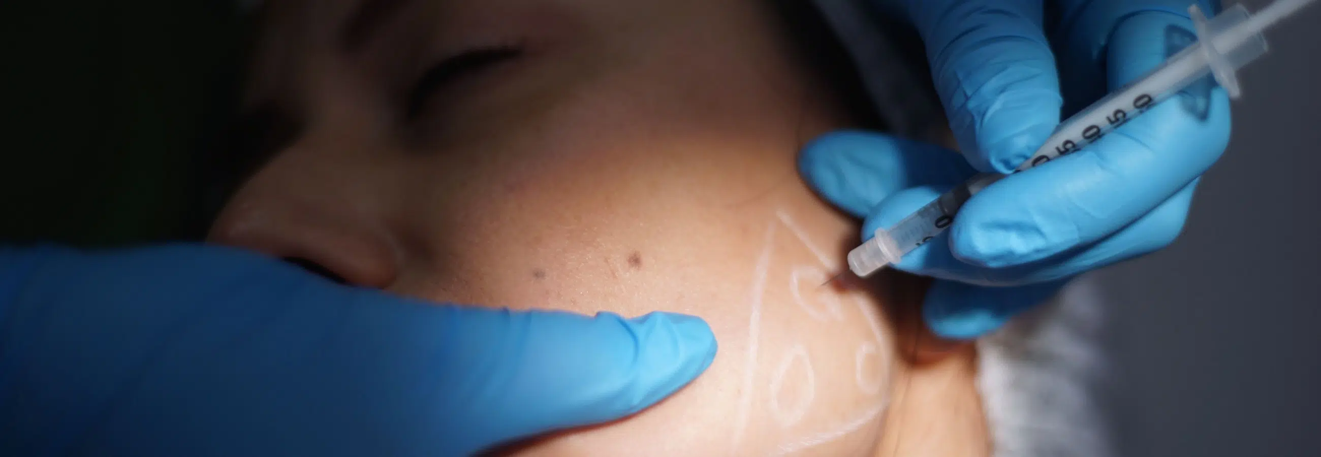 Preparer opération de chirurgie orthognatique