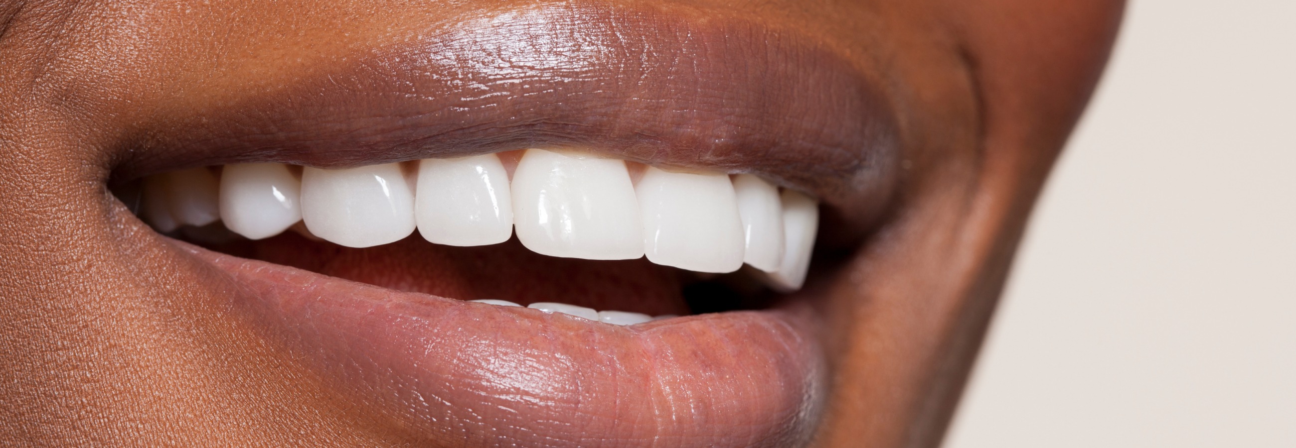 Extraction des dents de sagesse