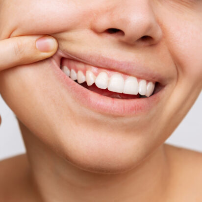 Extraction des dents de sagesse