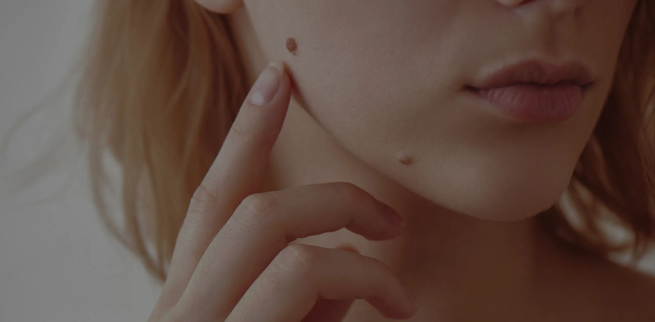 Grain de beauté