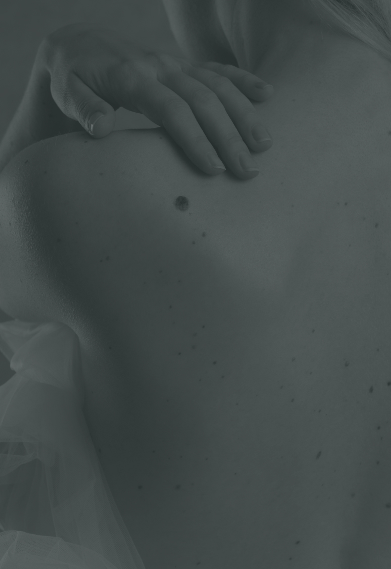 Grain de beauté