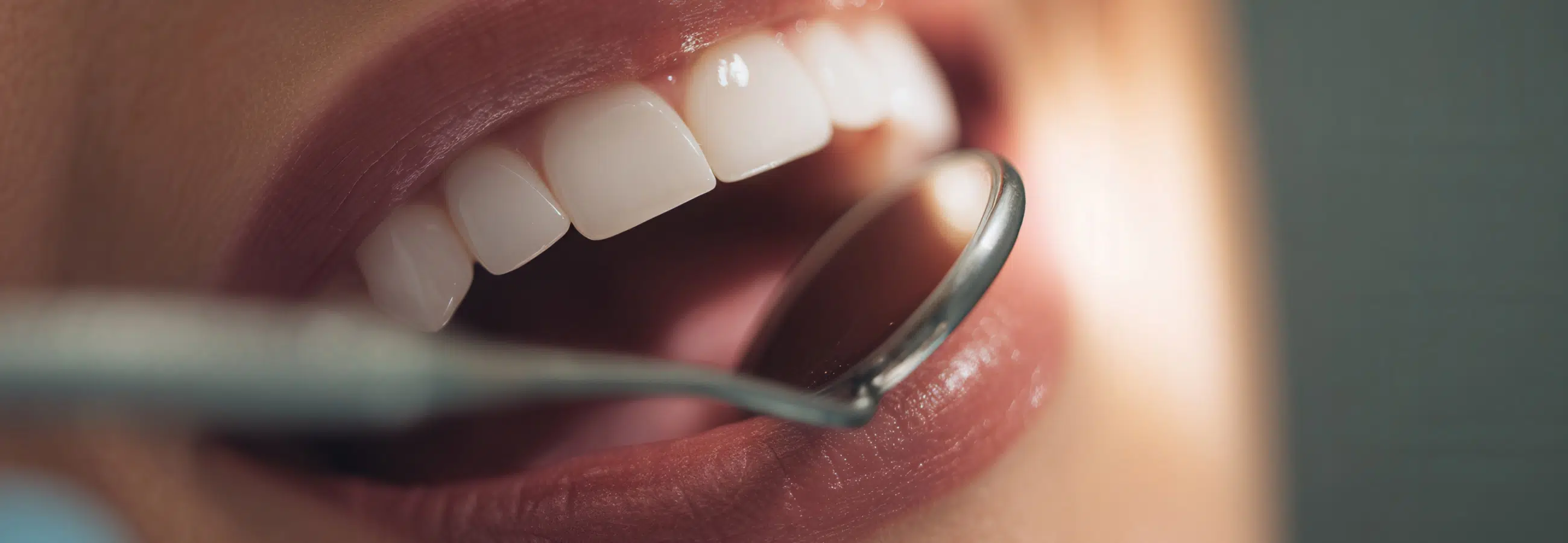 Opération des dents de sagesse