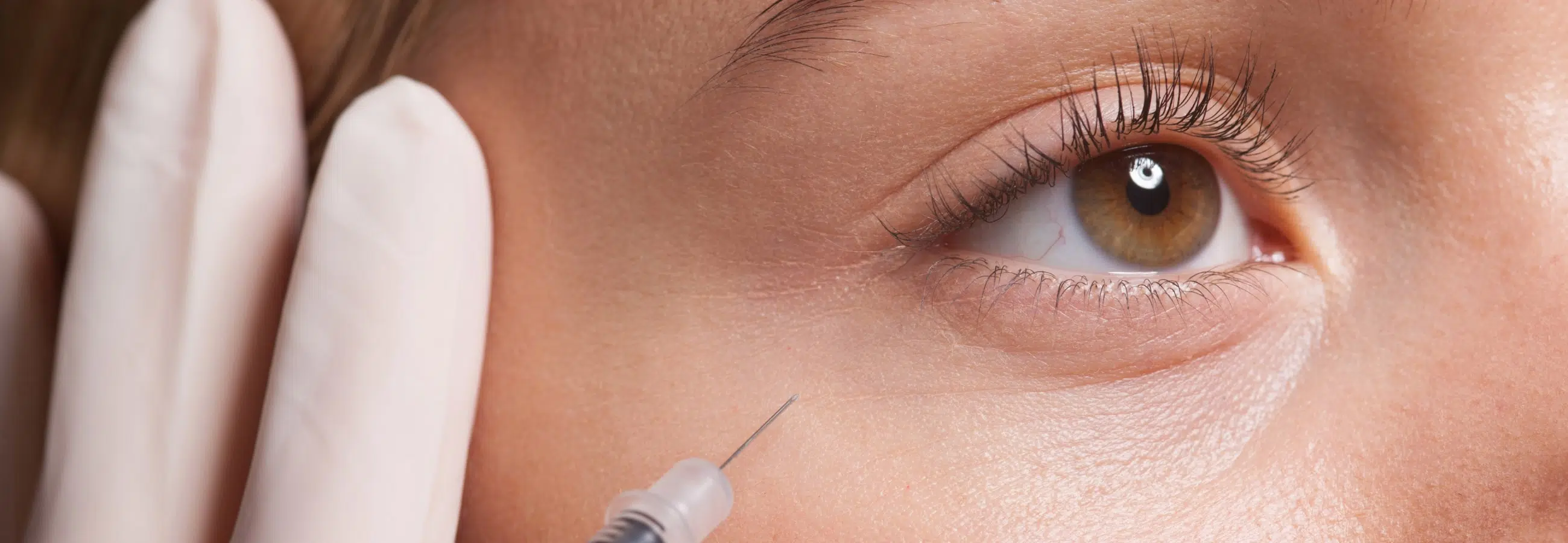 Injections d’acide hyaluronique