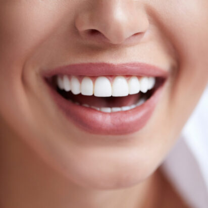 Chirurgie des dents de sagesse | Maxillyon | Lyon