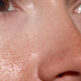 Botox : à quoi sert-il en médecine esthétique ?