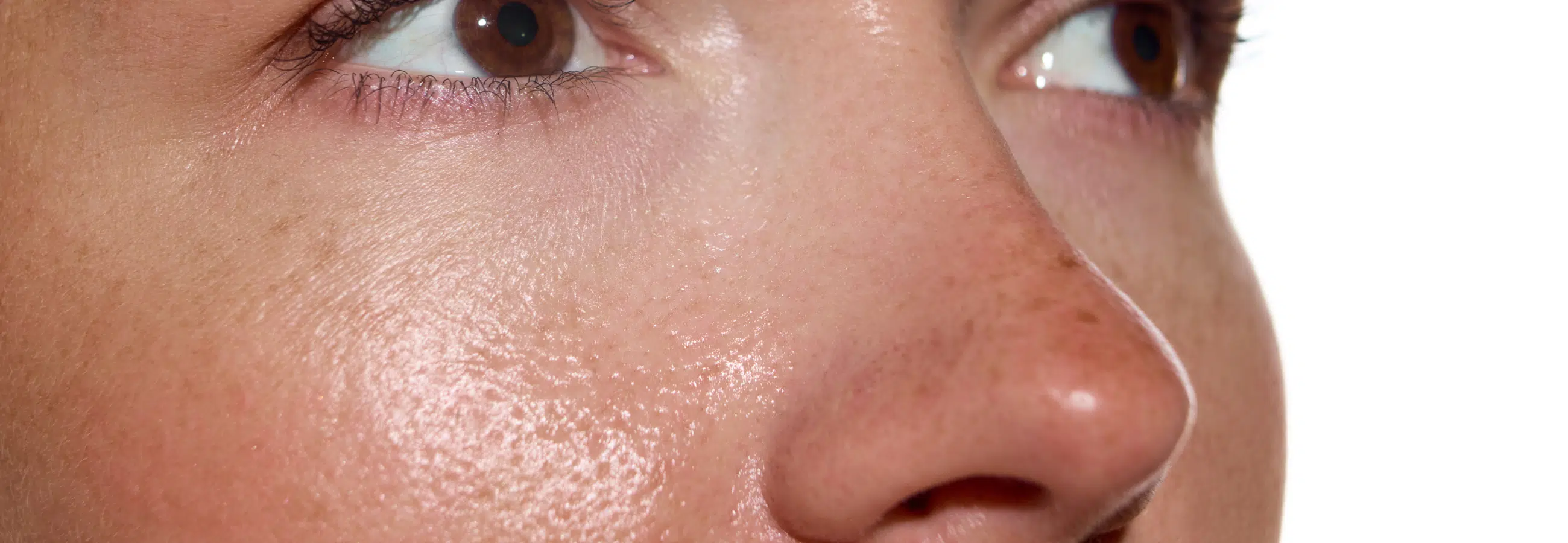 Botox | Maxillyon | Lyon