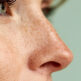 Rhinoplastie : comment obtenir un nez naturel et harmonieux ?
