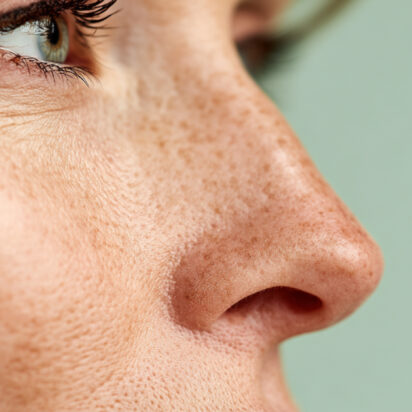 Rhinoplastie | Maxillyon | LyonRhinoplastie | Maxillyon | Lyon
