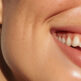 Peut-on garder ses dents de sagesse toute sa vie ?
